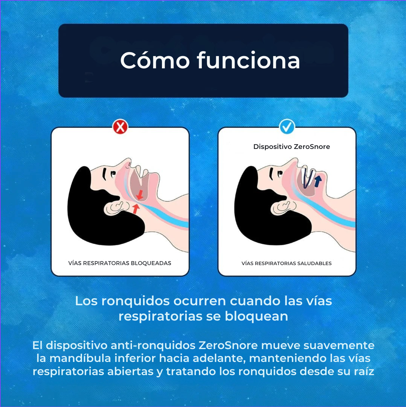 Adiós a los ronquidos con ZeroSnore™